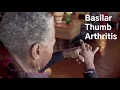 Basilar Thumb Arthritis and Arthroplasty