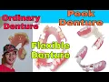 Ordinary na Pustiso vs Flexible Denture and Peek Denture Review Ano Ang Mas Maganda DATUAMBASTV