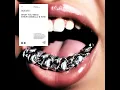 What You Need - Steve Angello & Wh0