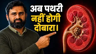 किडनी स्टोन बार-बार क्यों होता है? रसोई की 3 चीज़ें जो पथरी बनने ही नहीं देतीं #drrobin 