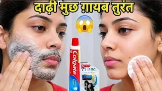 दो साल से परेशान थी😔एक चीज लगाते ही चेहरे के बाल गायब😱तुरंत प्रूफ || facial hair removal at home