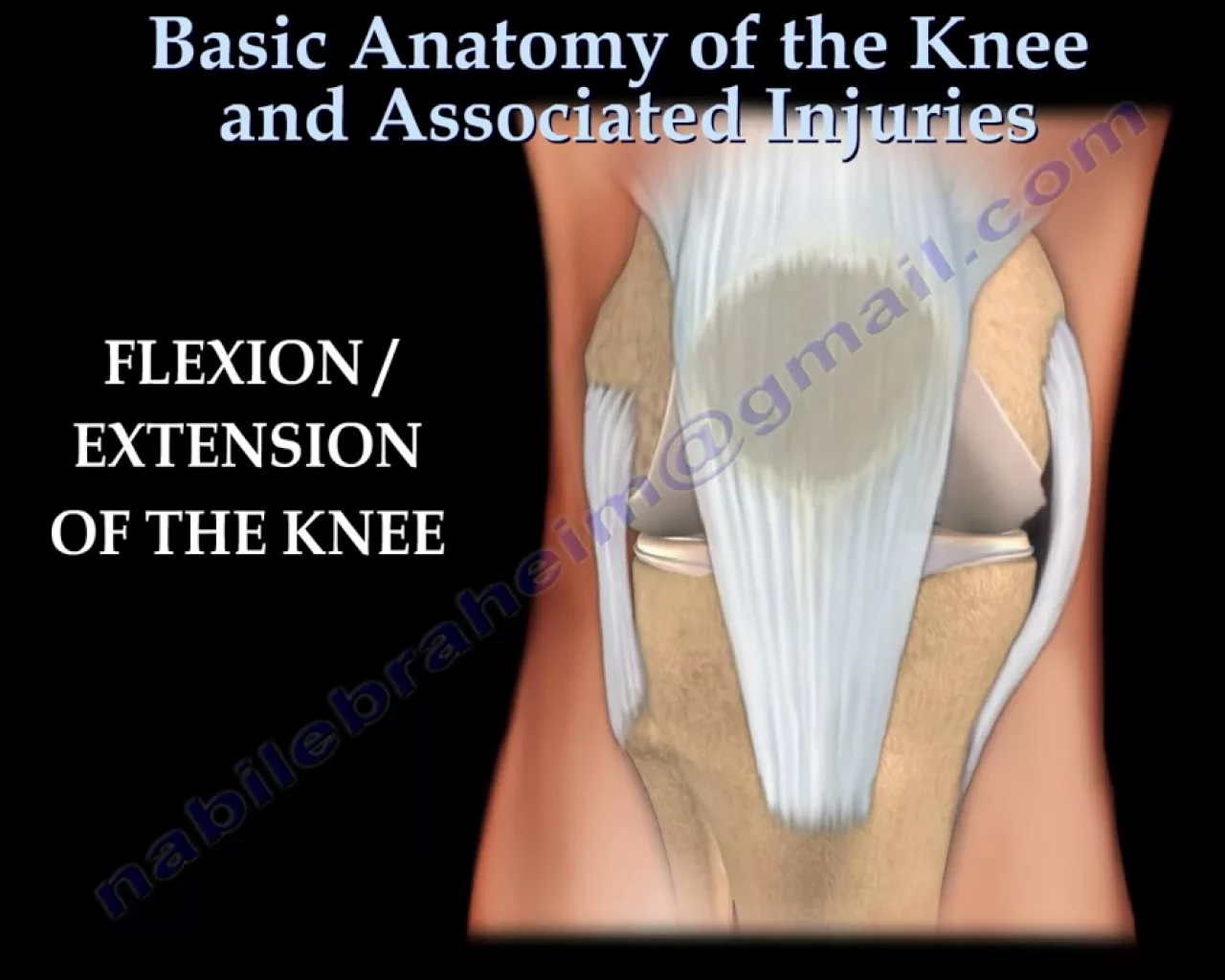 Knee  injury ,Injuries - Everything You Need To Know - Dr. Nabil Ebraheim