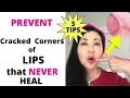 Prevent Cracked Corners of your Mouth that NEVER Heal 3 Tips to Prevent Angular Cheilitis