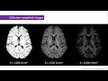 BrainMap On the quantification of axon diameter distributions using diffusion MRI