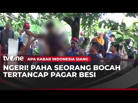 NAHAS! Paha Bocah di Bone Tertusuk Pagar Besi
