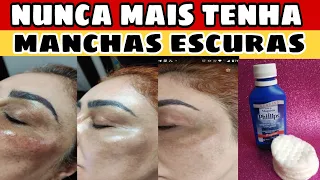 NAO JOGUE❌ MEU ROSTO ESTAVA ESCURO E COM MANCHAS TOP 3 RECEITAS REMOVA SUAS MANCHAS RUGAS E MELASMA