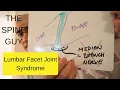 Lumbar Facet Joint Syndrome