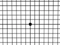 3 Amsler Grid Test