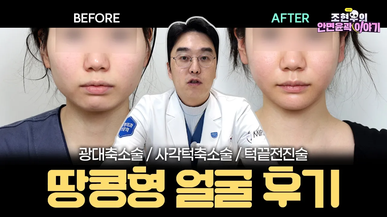 넓어 보이는 얼굴형! 윤곽 3종(광대+사각턱+무턱) 케이스 리뷰