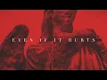 Download Lagu Sam Tinnesz - Even If It Hurts [Official Audio]