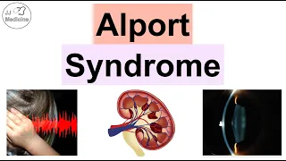 Alport Syndrome: The Genetic Condition That Affects Kidney, Eyes and Ears