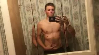 Pectus Excavatum Surgery Nuss Procedure Post Op Week 1 After Surgery Scarring Part 3 