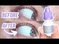 LUMIFY Redness Reliever Eye Drops Review Real Results Live Demo Bright White Eyes Fast Quick