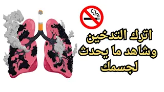 اترك التدخين وشاهد ما يحدث لجسمك بعد 20 دقيقة فقط 