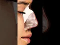 Download Lagu SKIN ⭕️ Superficial structure covering all elements of the outer nose. #kaminskyi