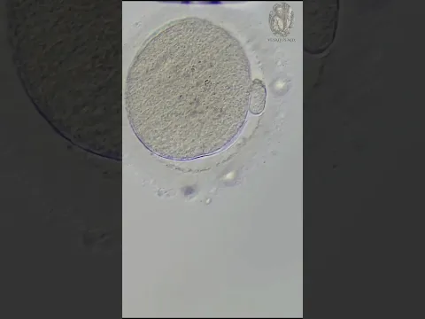 Fertilización in vitro