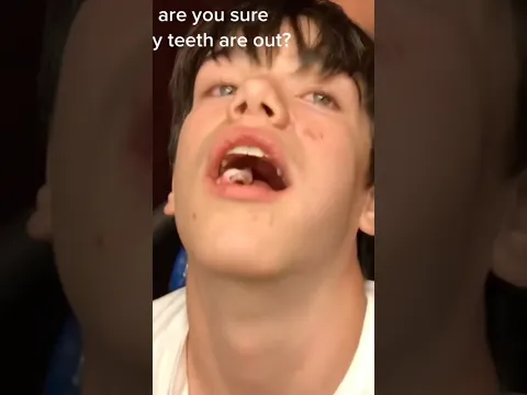 That time I got my wisdom teeth out 🥴