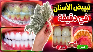 في دقيقتين فقط تبييض الأسنان في المنزل كيفية تبييض الأسنان يجب أن يعلم الجميع!