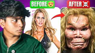 Top 4 Celebrities Plastic Surgery Gone Wrong!!! 😱