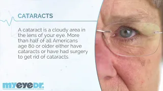 What Are Cataracts with Dr Lyons Dr Salvatore