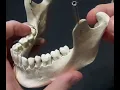 Identification of Bony Landmarks - Mandible Skull