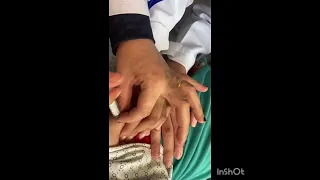 ممرضة لاول مرة في حقنة عضل 