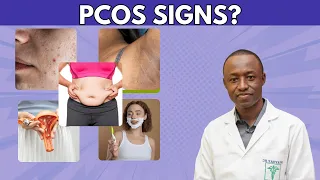 After 1000s of Patients, These Are the 6 PCOS Signs I Spot Instantly