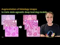 304 - Augmentation of histology images to train stain-agnostic deep learning models