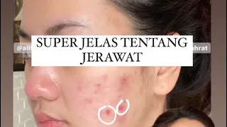 Jujur jujuran tentang JERAWAT ku | cara aku sembuh dari jerawat acne