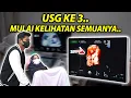 Download Lagu BISMILLAH USG KE 3… KELIHATAN SEMUANYA??