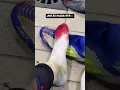 Lamine Yamal s foot after the game against Las Palmas