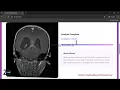 Final Year Project - Brain Tumor Classification Using Deep Learning Model Python Flask