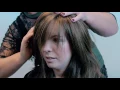 Download Lagu Alopecia, haarverlies en oplossingen
