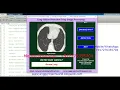 Lung Cancer Detection Using Image Processing Matlab Project With Source Code Final Year Project