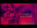 Download Lagu Madonna - Fragile (Skin Bruno AI Version)
