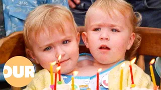 Two Heads One Body The Remarkable Story of Conjoined Twins Katie Eilish Our Life