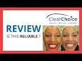 CLEARCHOICE DENTAL IMPLANTS Test Review in 2024 Is this reliable Benefits Cons Score