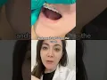How Ortho Wax SAVED Me During Braces