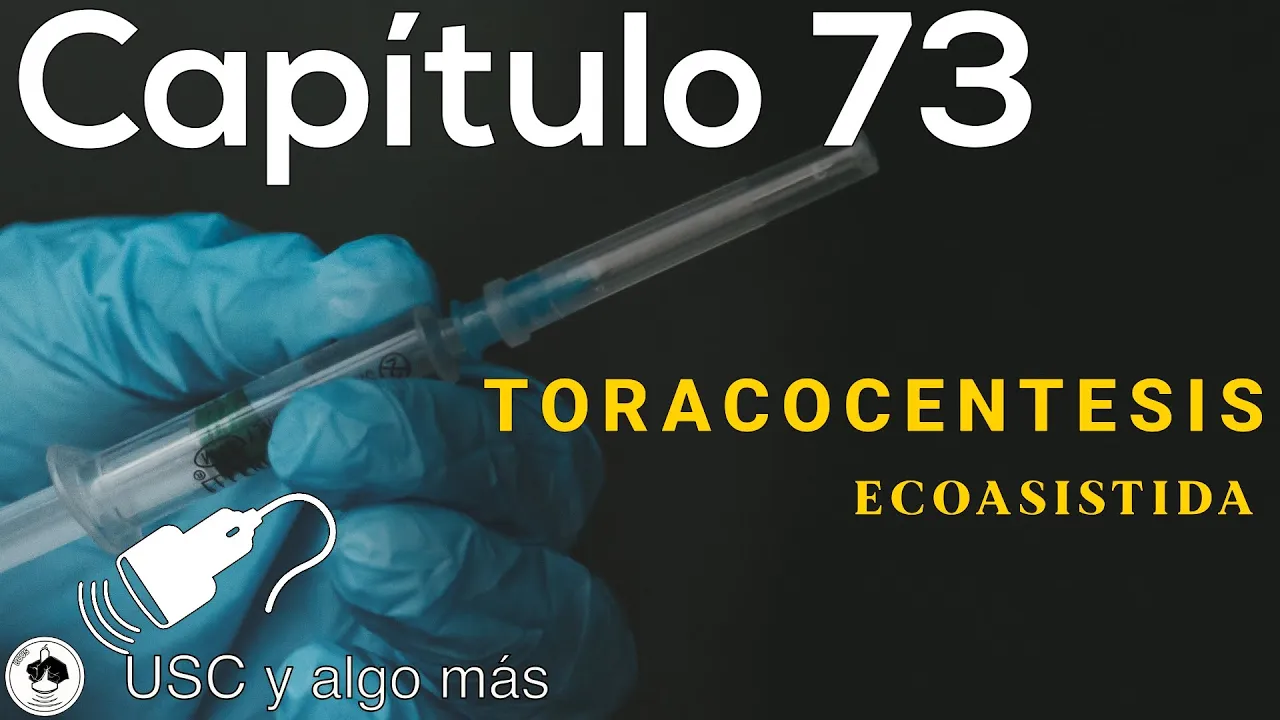 Capítulo 73: Toracocentesis Ecoasistida