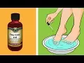 Tea tree oil is far more useful than you think - 7 reasons to have tea tree oil in your house