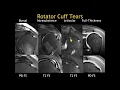 University of San Diego Presents Radiology Review Course - A CME Teaching Activity