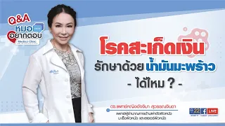 น้ำมันมะพร้าวช่วยรักษาโรคสะเก็ดเงินได้จริงหรือไม่