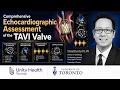 Comprehensive Echocardiographic Assessment of the TAVI Valve