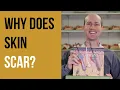 Why does skin SCAR What is a scar and why does scar tissue look different