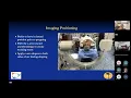 Performing an Anterior Cervical Discectomy and Fusion Robert K Eastlack MD