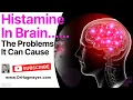 Is Excess Brain Histamine The Cause of Your Symptoms Histamine causes brain fog