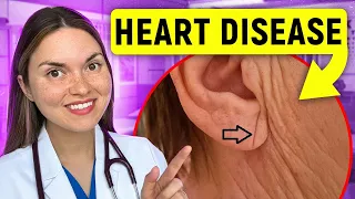 13 Signs of HEART DISEASE You Can See: Doctor Explains