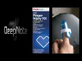 CVS Finger Injury Kit Instructions - Finger Splint and Finger Buddies