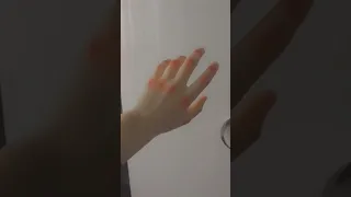 صور ايدين مجروحه كأنها لك 