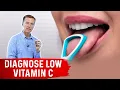 The Tongue Can Determine a Vitamin C Deficiency